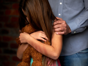 Erkaklar mushuklari yalangoch