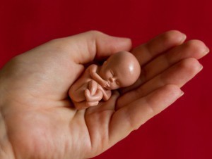 O‘zbekistonda qaysi hududda eng ko‘p homila “abort” qilingani aytildi 
